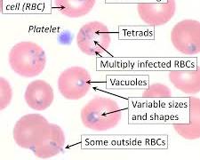 Babesiosis pada Sapi: Ancaman Serius bagi Peternakan